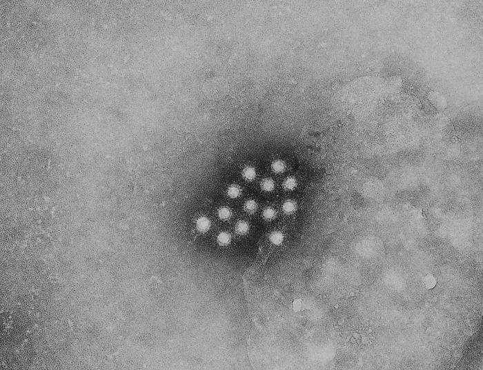 A型肝炎病毒(Hepatitis A virus)